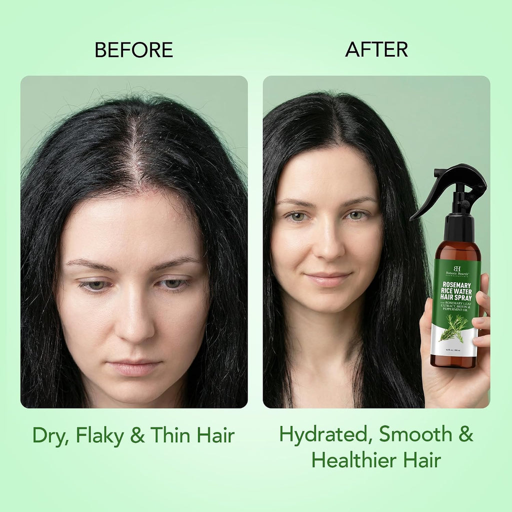 Rosemary and Rice Water Spray for Hair Growth - 6.8 Fl Oz