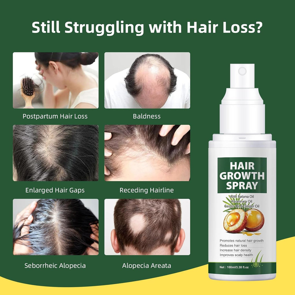 Hair Growth Oil Spray Batana Oil Dr Sebi Organic with Rosemary Castor Ginger, Natural Hair Loss Treatments for Women Men Promotes Regrowth Reduces Loss Thinning Strengthen Scalp Nourishes Dry
